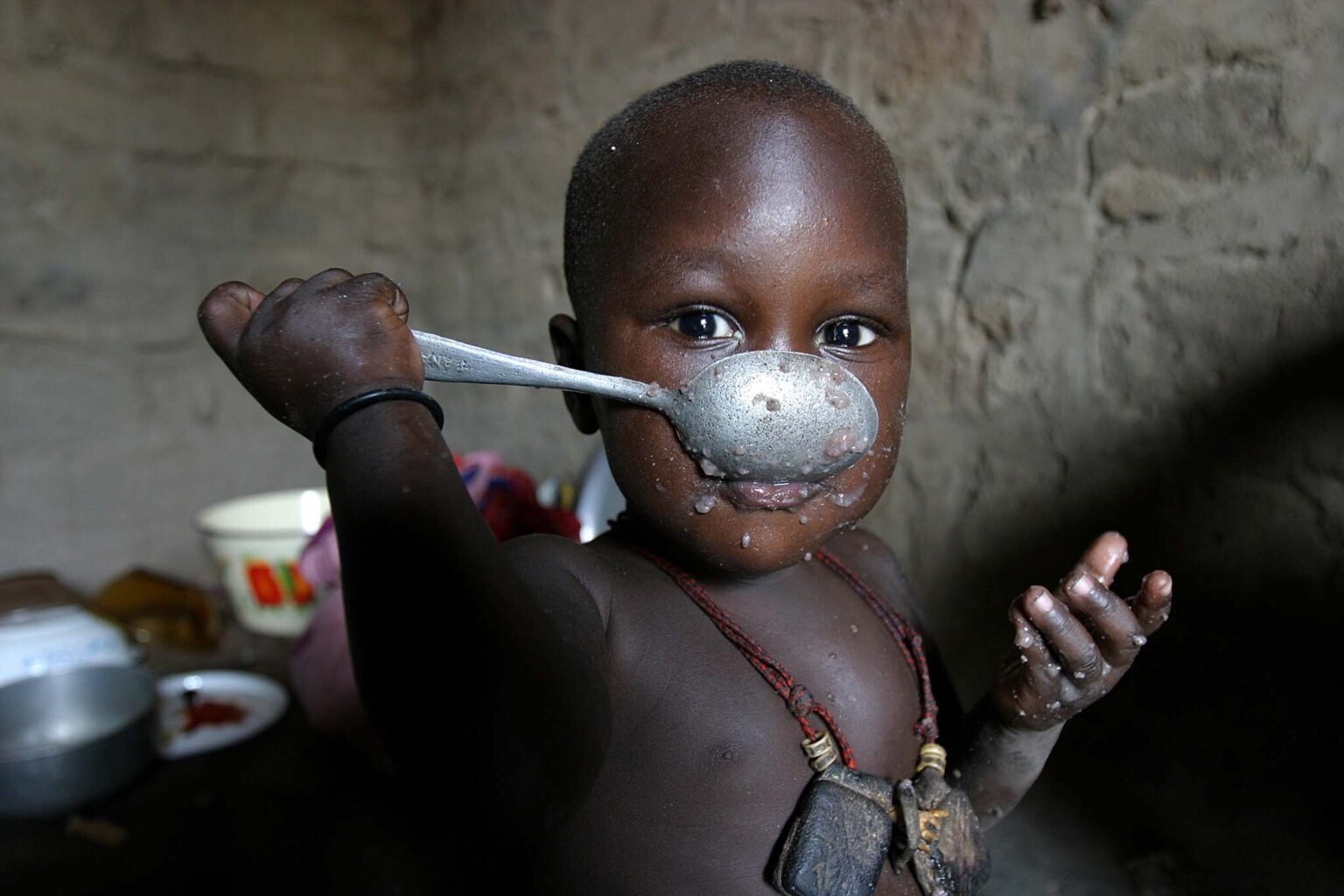 Photo: Pierre Holtz/UNICEF
